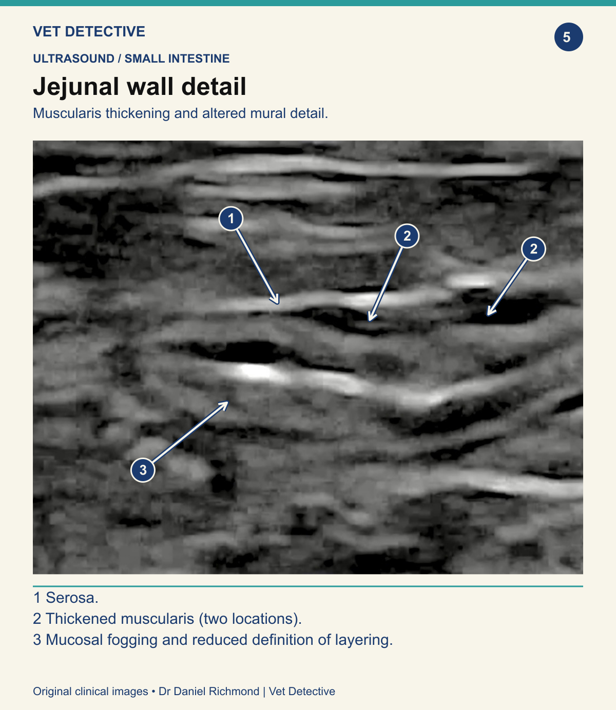 Linear ultrasound view of a feline jejunal wall with labelled serosa, thickened muscularis and reduced definition of mucosal layering.