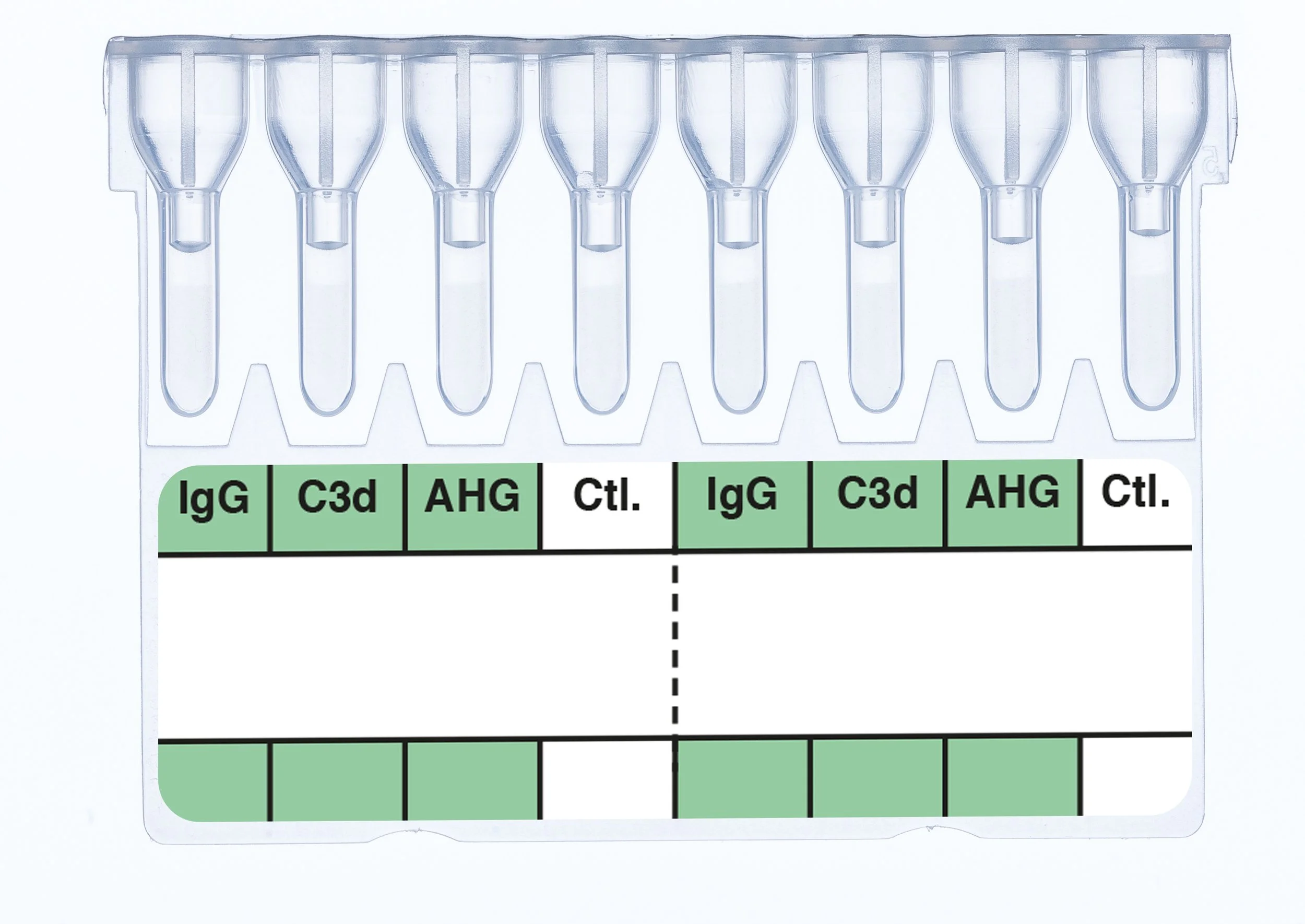 A laboratory test strip with multiple test zones labeled IgG, C3d, AHG, and Ctl., with some zones shaded green.