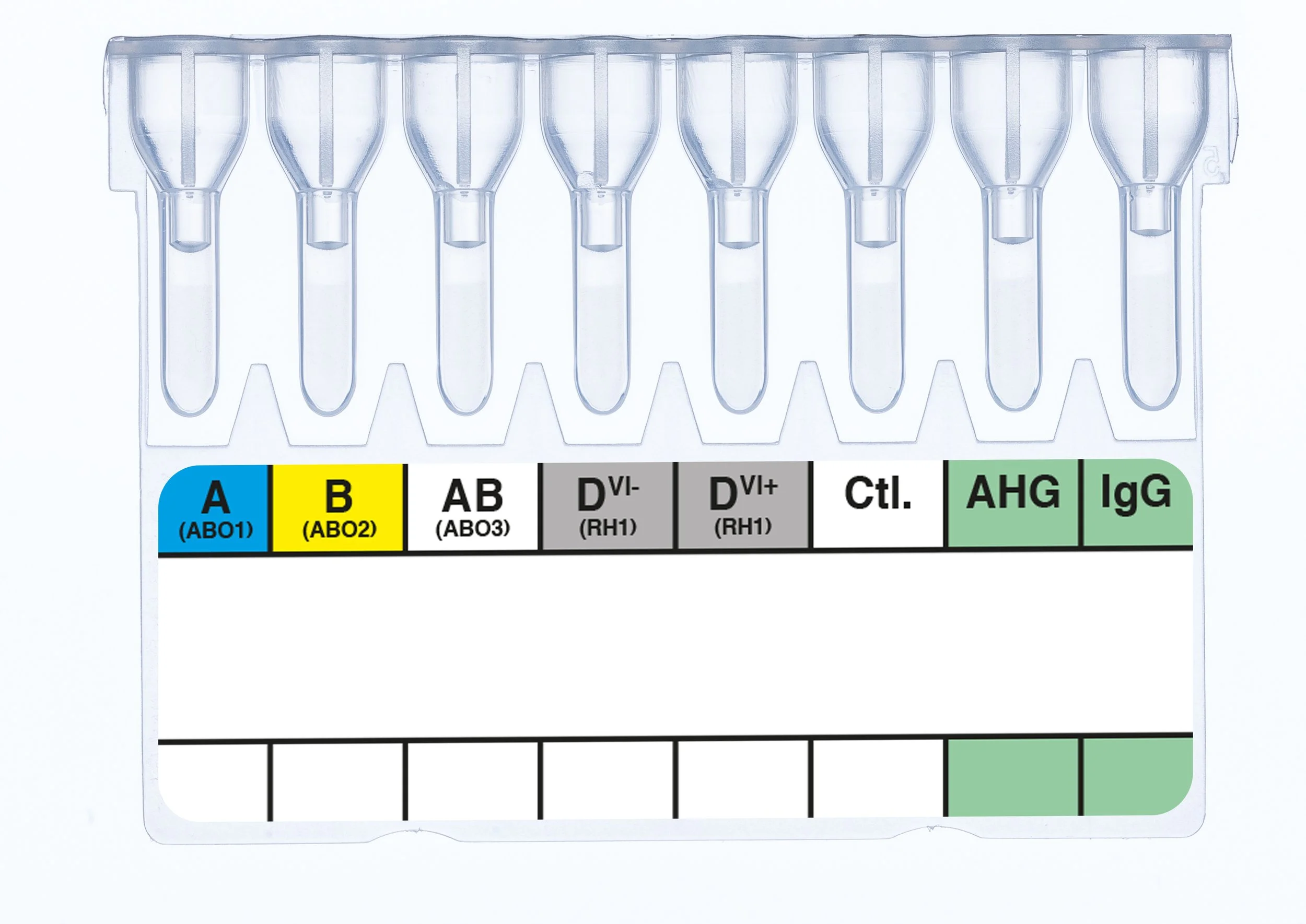 A laboratory blood type testing tray with labeled test tubes for A, B, AB, D-negative, D-positive, Control, AHG, and IgG samples.