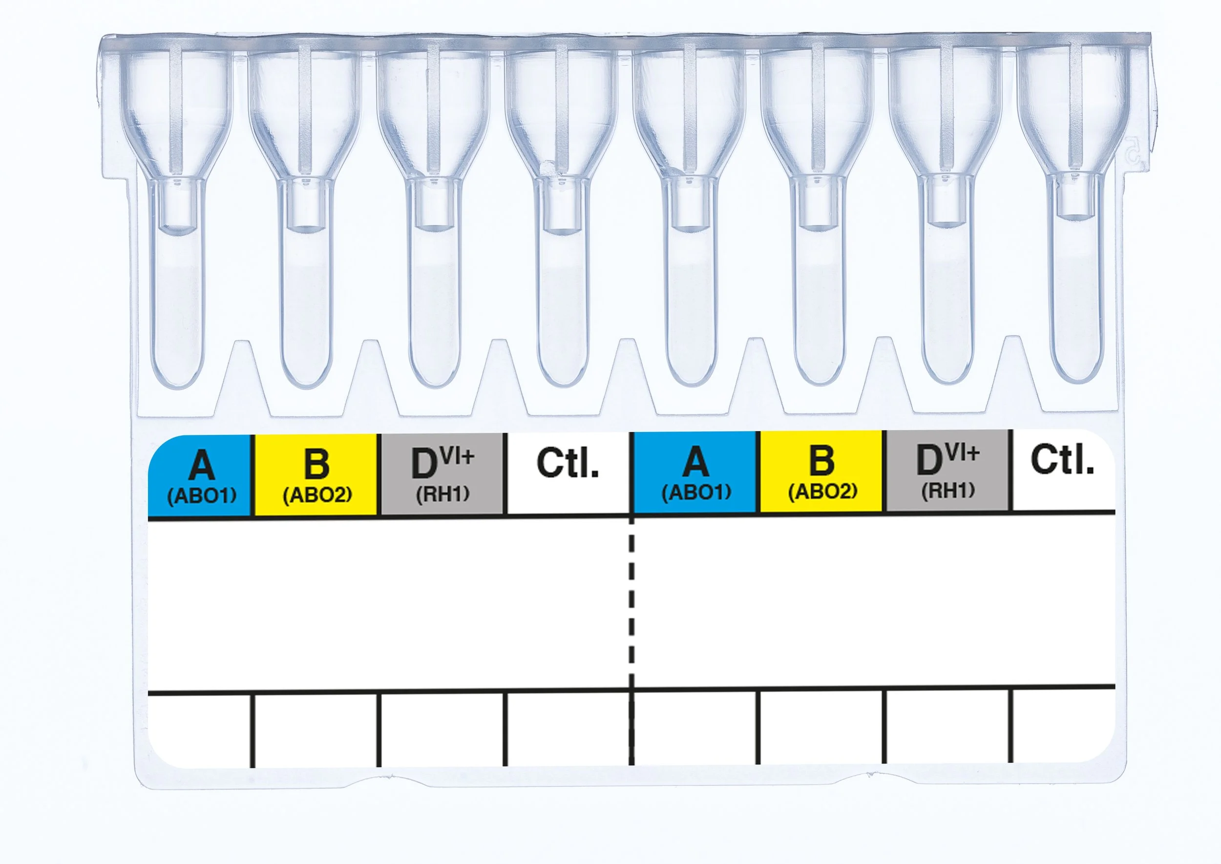 Blood collection test tube rack with nine test tubes and a color-coded chart showing blood types and their codes.