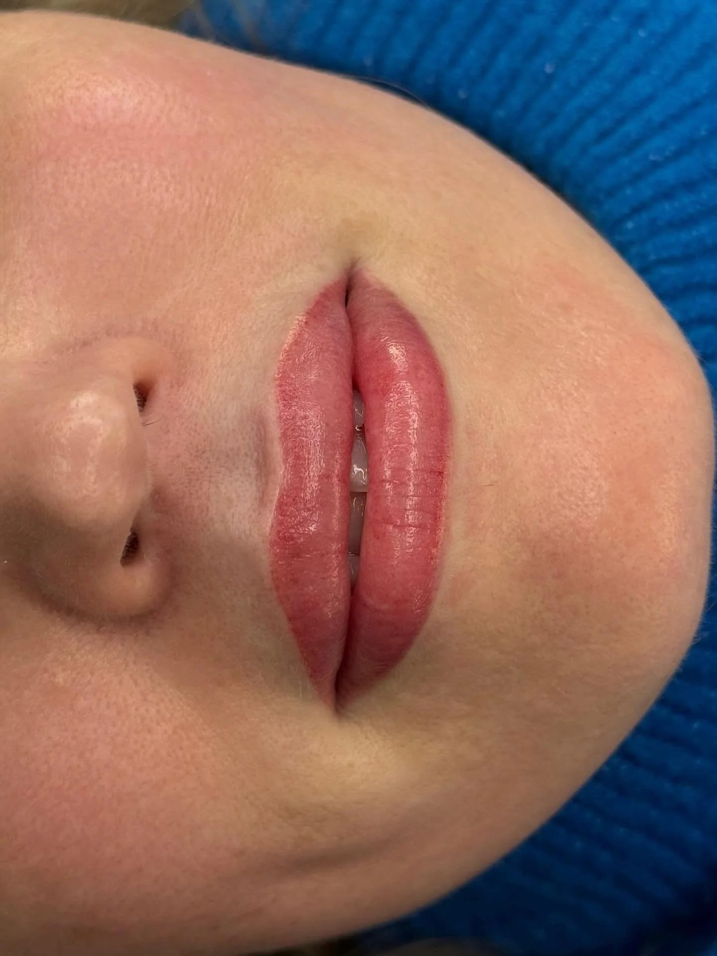 &bull; B L U S H &bull; 

Soft, fresh lip blush 💋✨

Enhancing the natural lip tone, adding definition to the border and giving that healthy, even colour - without the need for lipstick every day 🙌🏼

Lip blush is the perfect treatment if your lips 