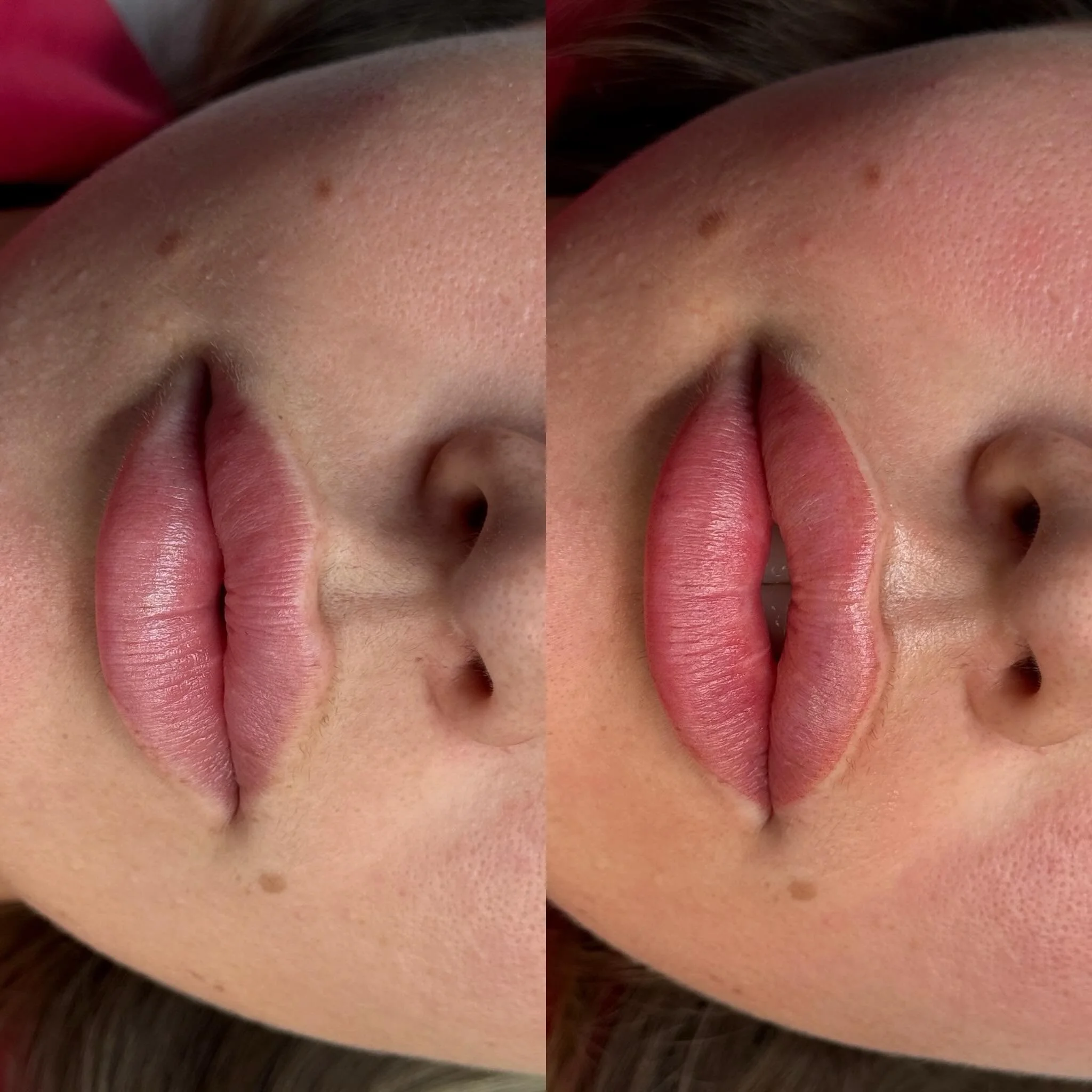 Lip blush doesn&rsquo;t have to be bold to be beautiful 🤍

A soft wash of colour, subtle definition and a more even lip tone can make all the difference.

No harsh lines. No bright colours. Just a natural, healthy-looking result that enhances your l