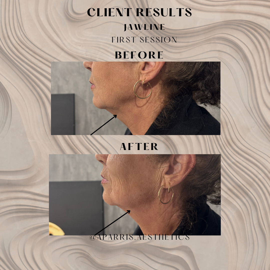 2nd.zip - Anne margaret 1v1.png