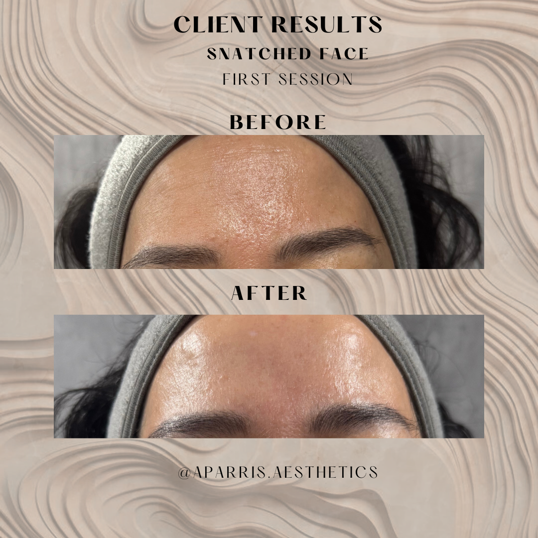 2nd.zip - Diony 1v1 (3).png