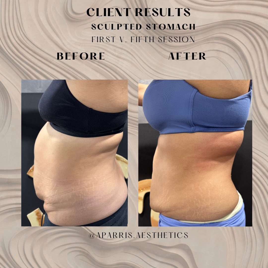 Neutral Minimalist Simple Elegant Marble Quote Instagram Post.zip - char 1v5 ss sv.png