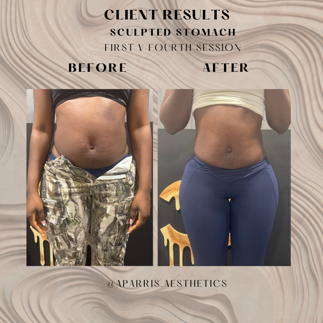 2nd - Harletty 1v4.png