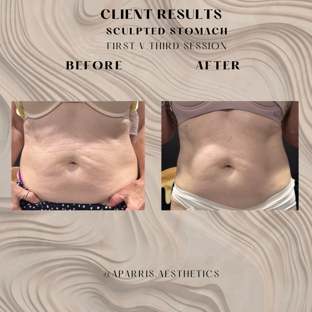 2nd.zip - Beth short 1v3.png