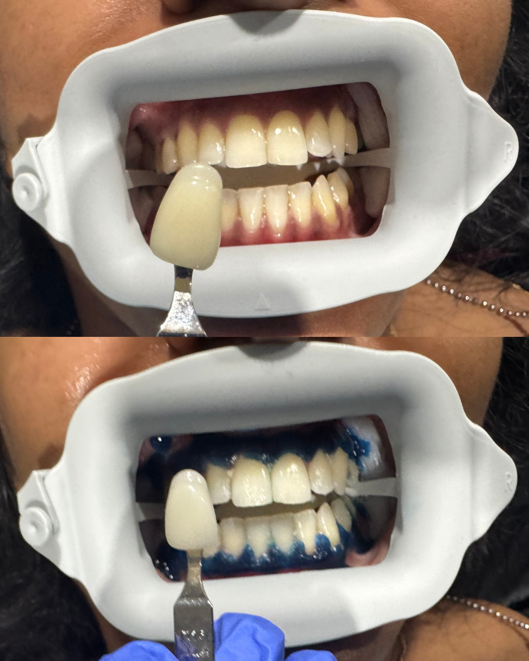 Untitled design - 3.png