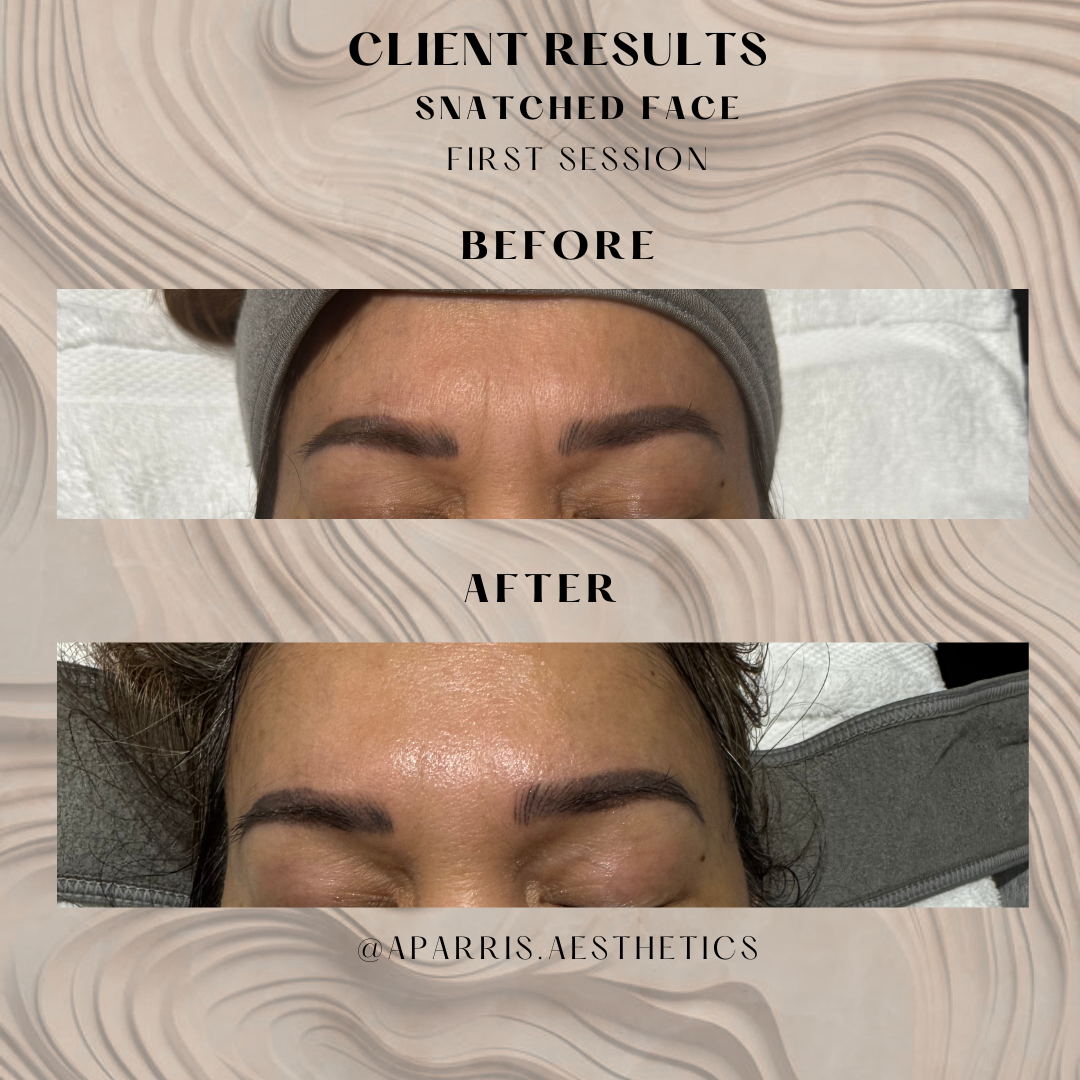 2nd.zip - Rhea 1v1.png