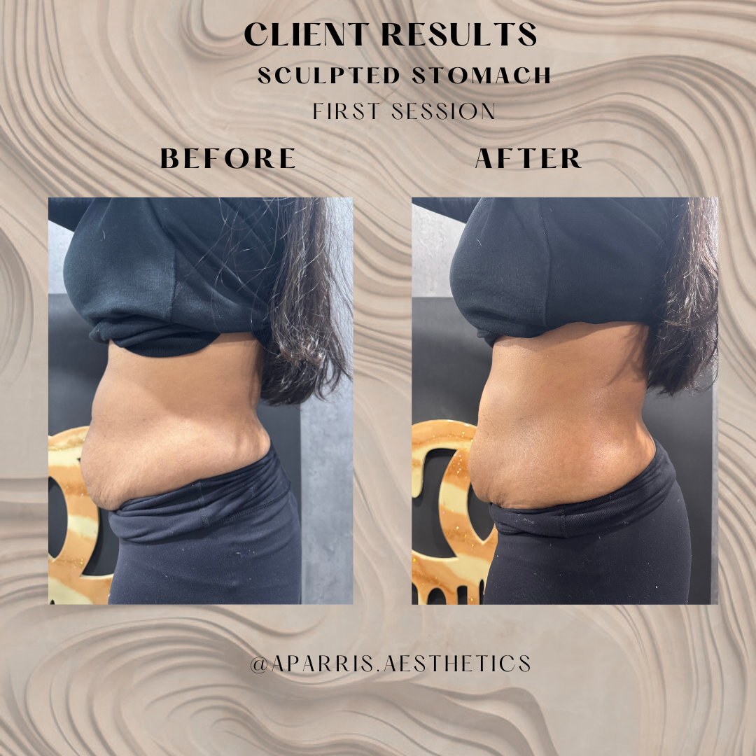 Neutral Minimalist Simple Elegant Marble Quote Instagram Post.zip - Sameera 1 ss sv.png