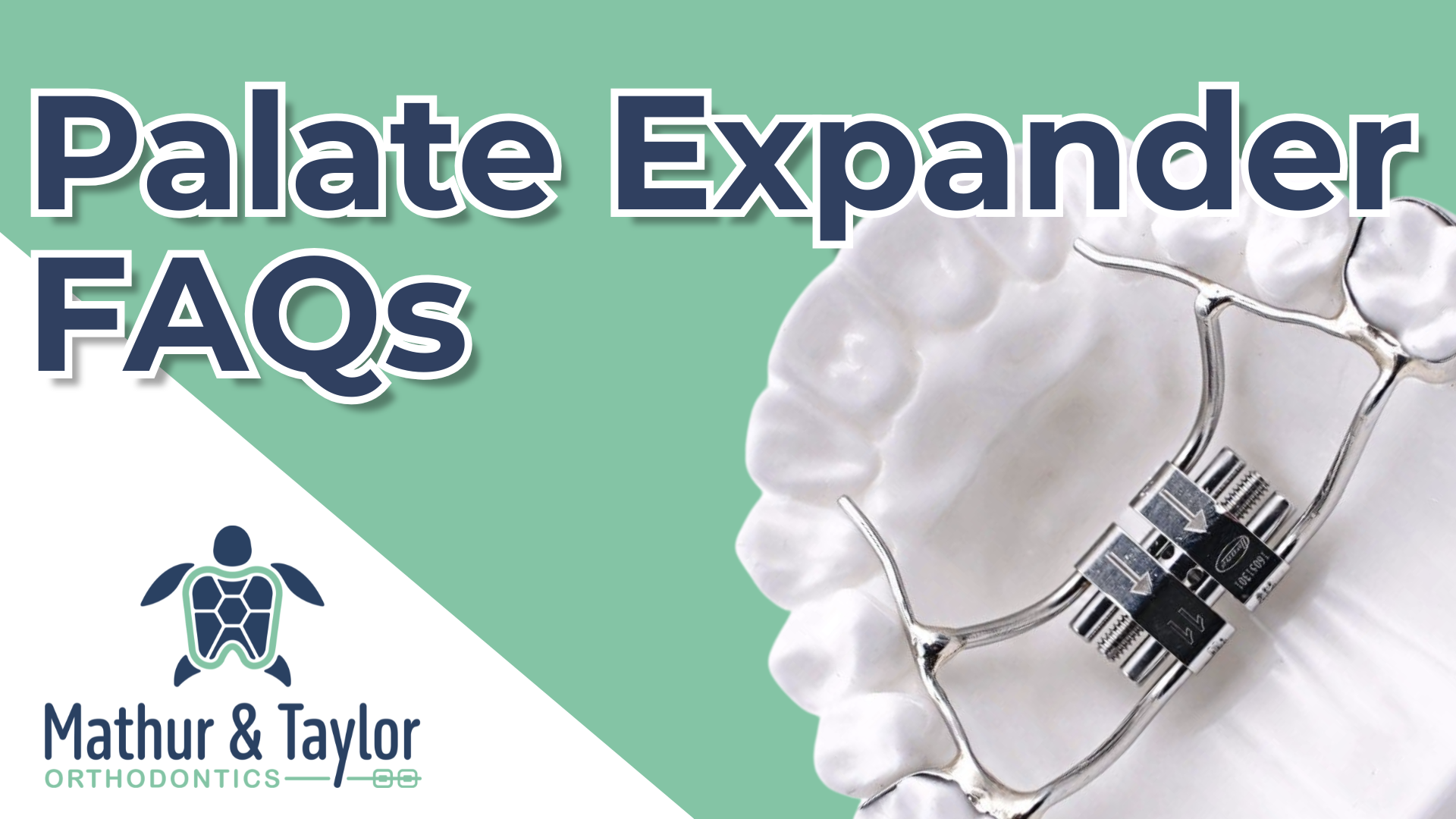 Palate Expander FAQs