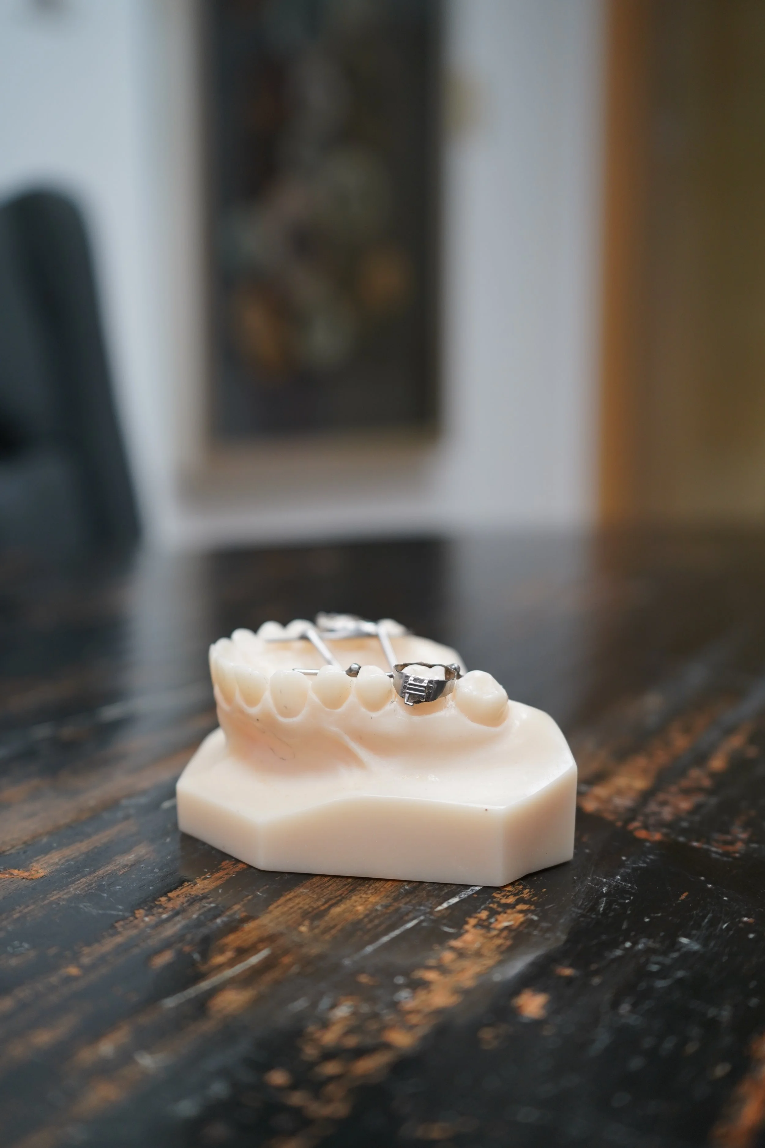 A dental model with braces on a dark wooden table.
