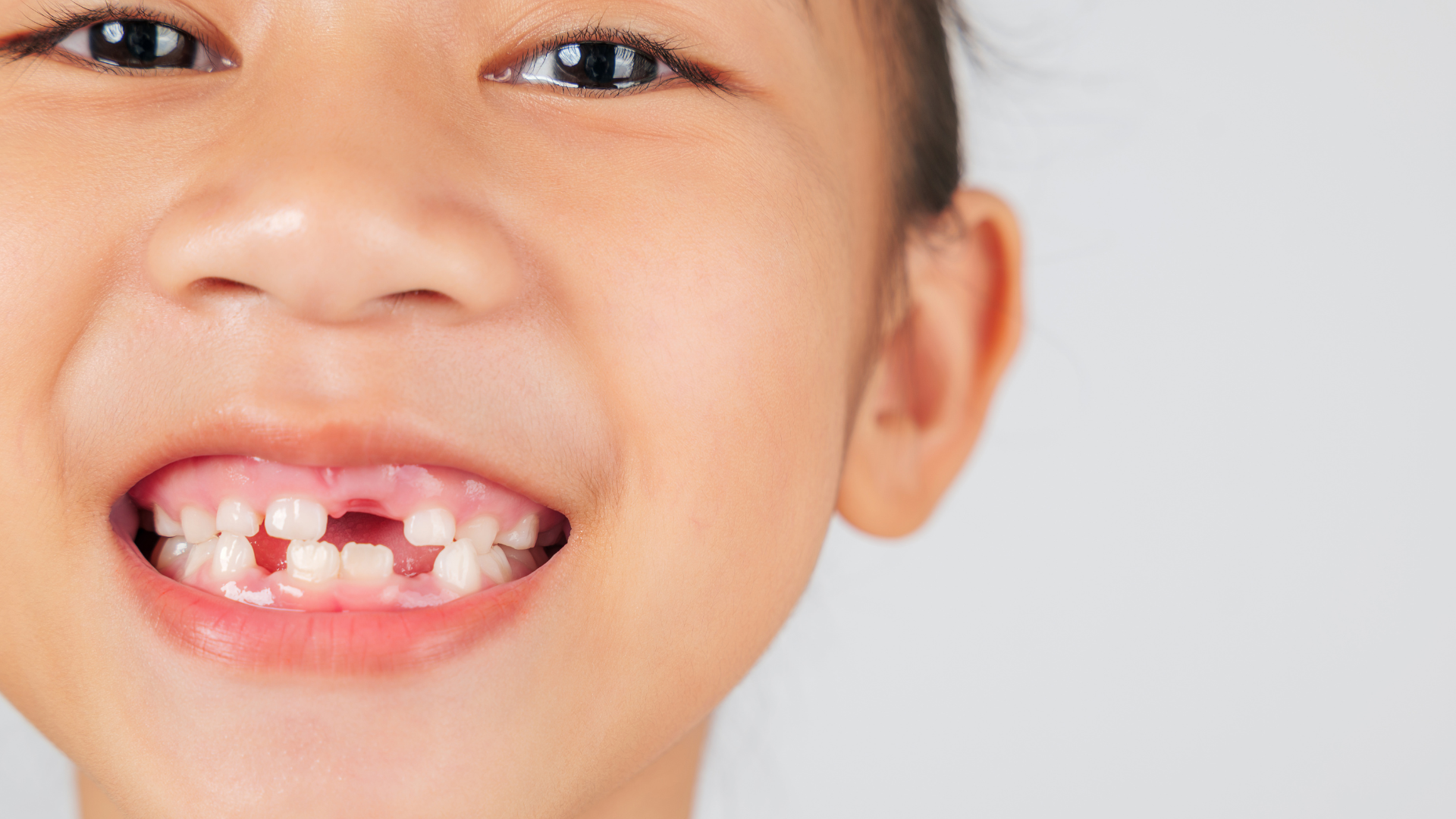 A child smiling with missing baby teeth.