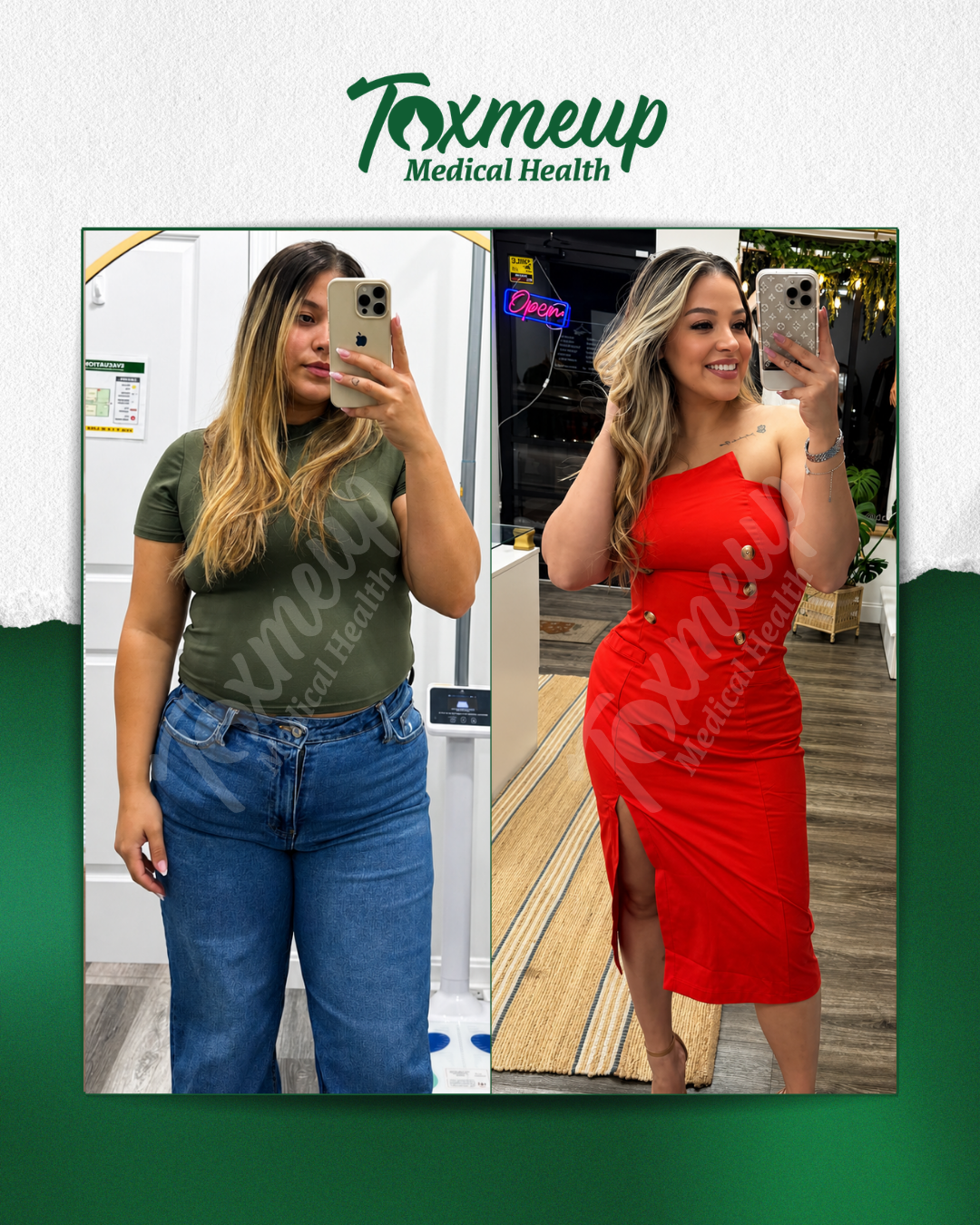 Toxmeup patient before and after result