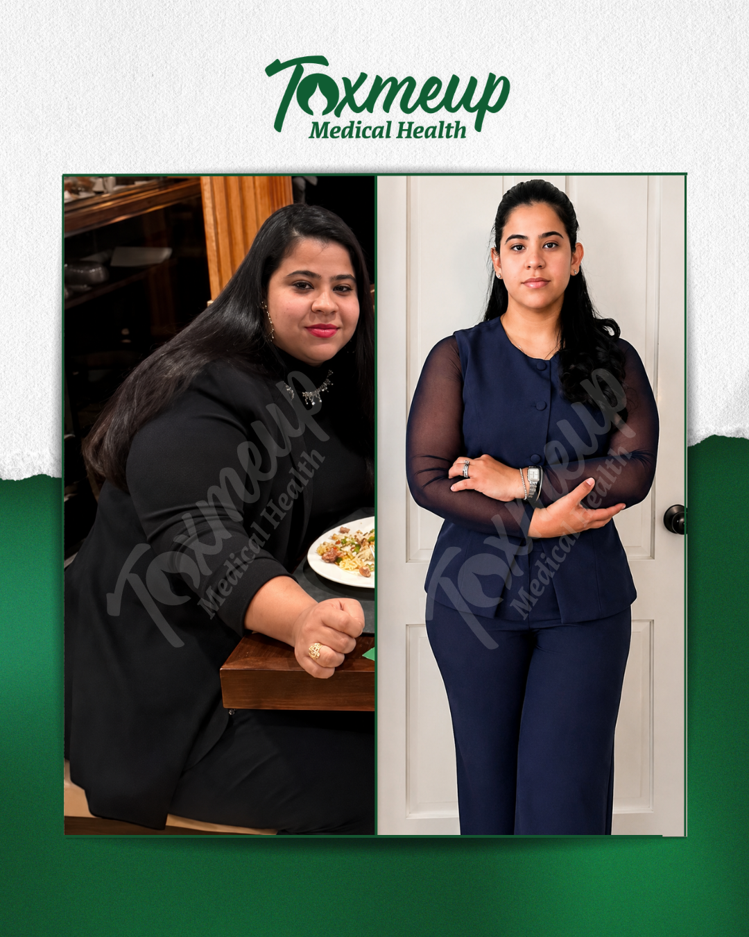 Toxmeup patient before and after result