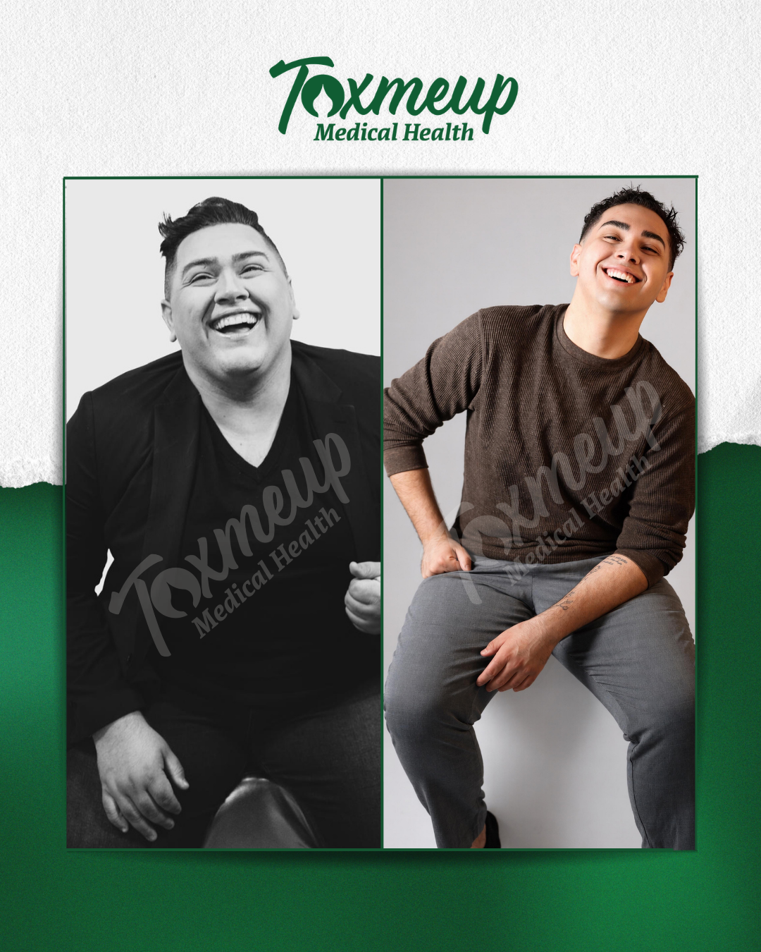 Toxmeup patient before and after result