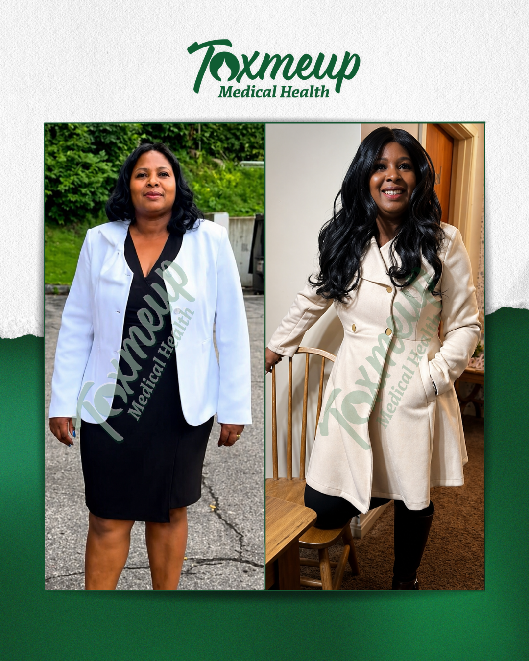 Toxmeup patient before and after result