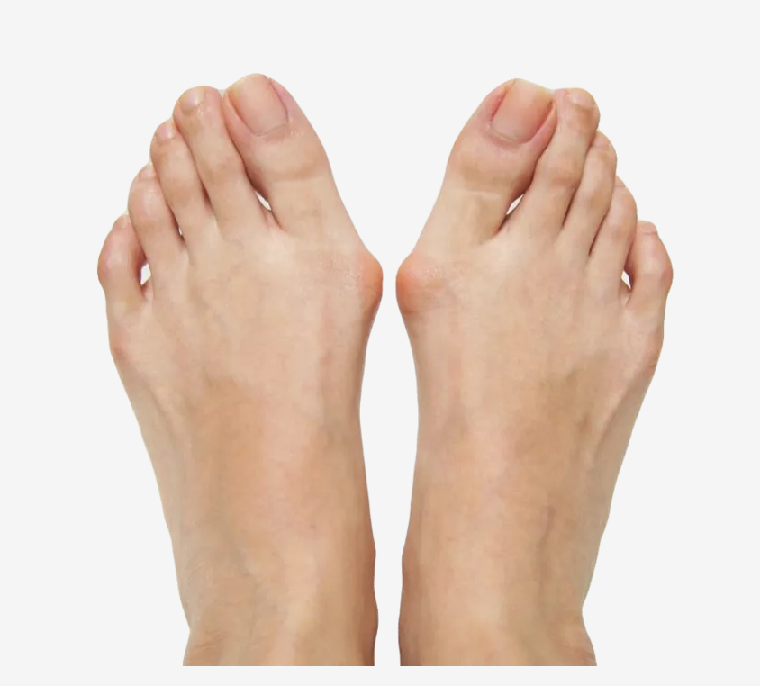 Close-up of two human feet with toes curled downward against a white background.