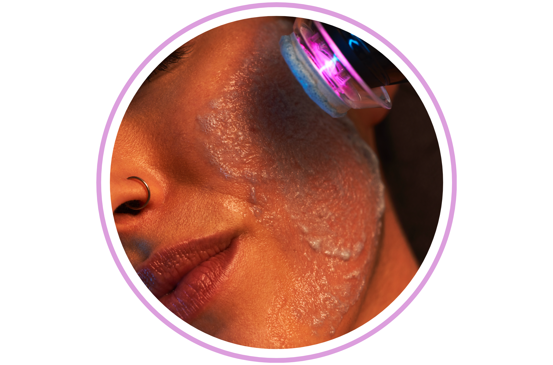 Glo2Facial oxfoliation treatment at Calla Ink & Aesthetics in Lakewood Ranch providing advanced skin rejuvenation
