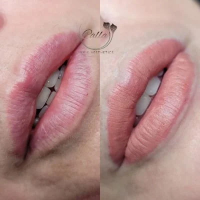 Lip BLushing Lakewood Ranch Florida