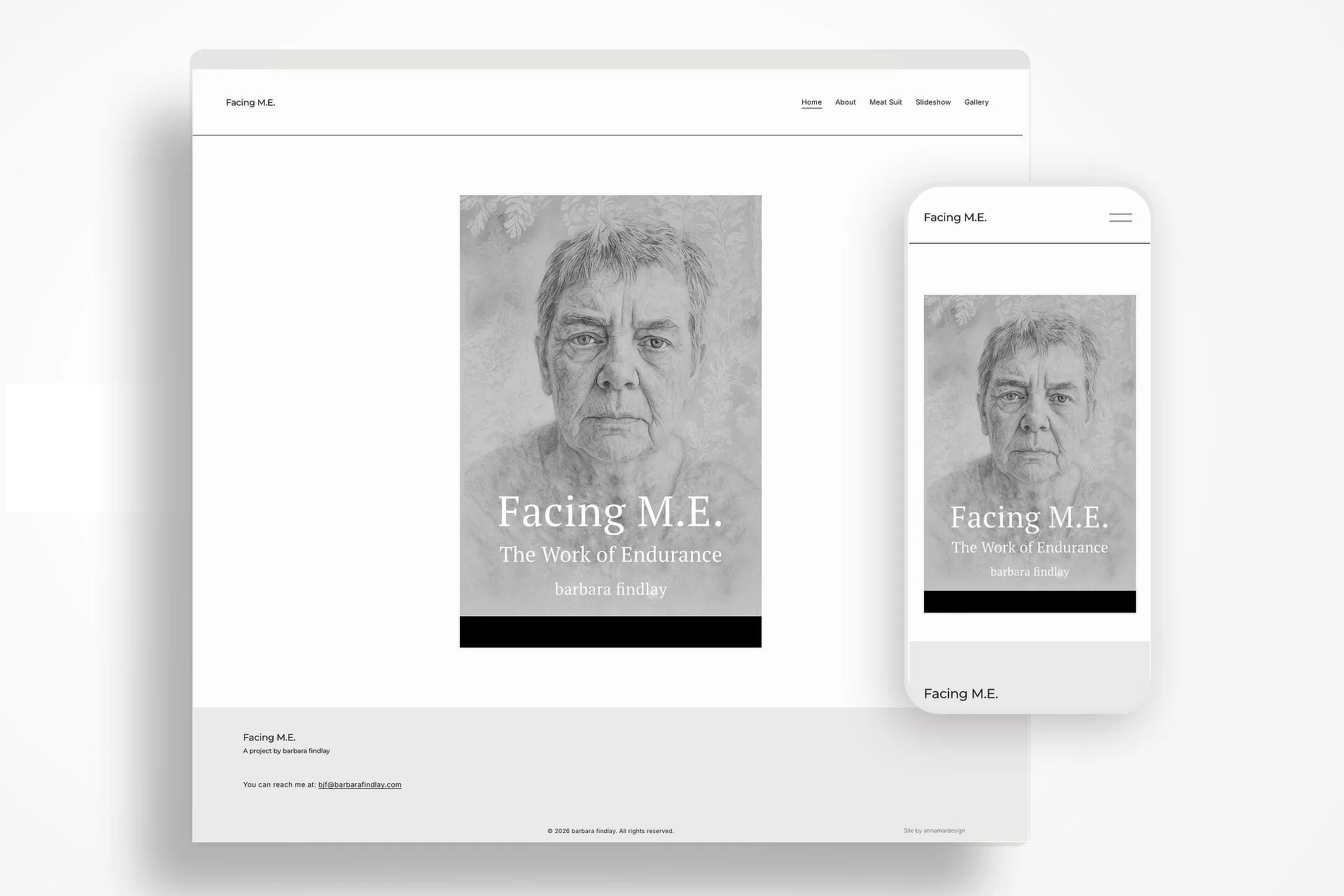 barbara findlay Facing M.E. Website Design Anna Mar Design