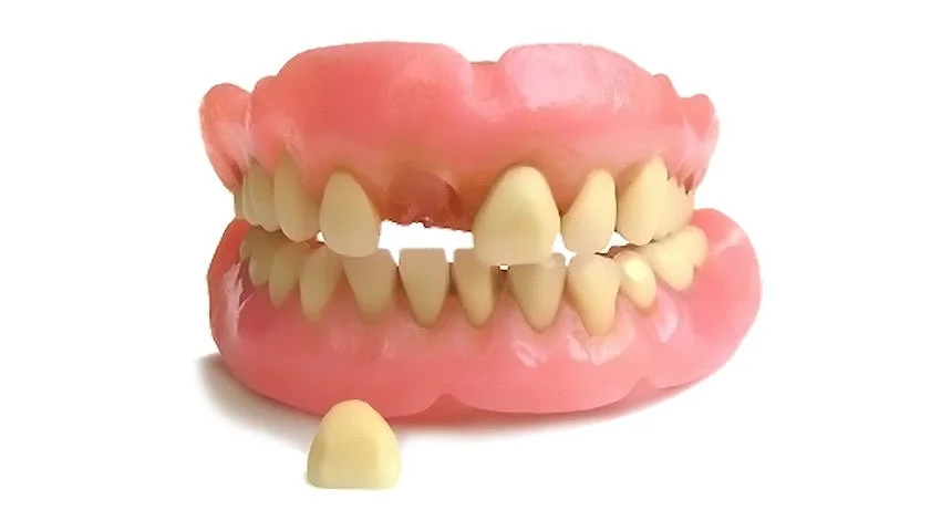 Denture with worn teeth and a single tooth placed in front.