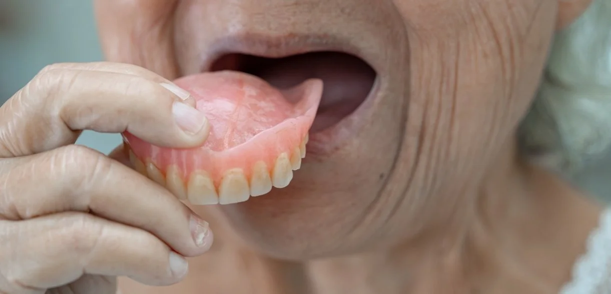 An elderly person holding a set of dentures near their open mouth.