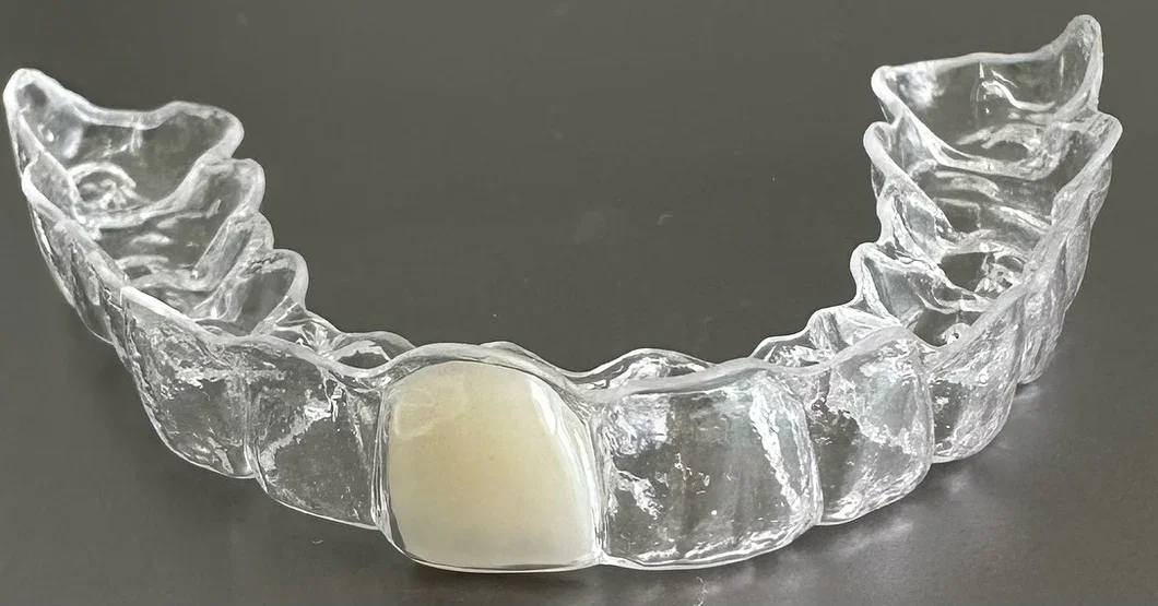 A clear dental retainer with a white dental crown on the front left tooth.