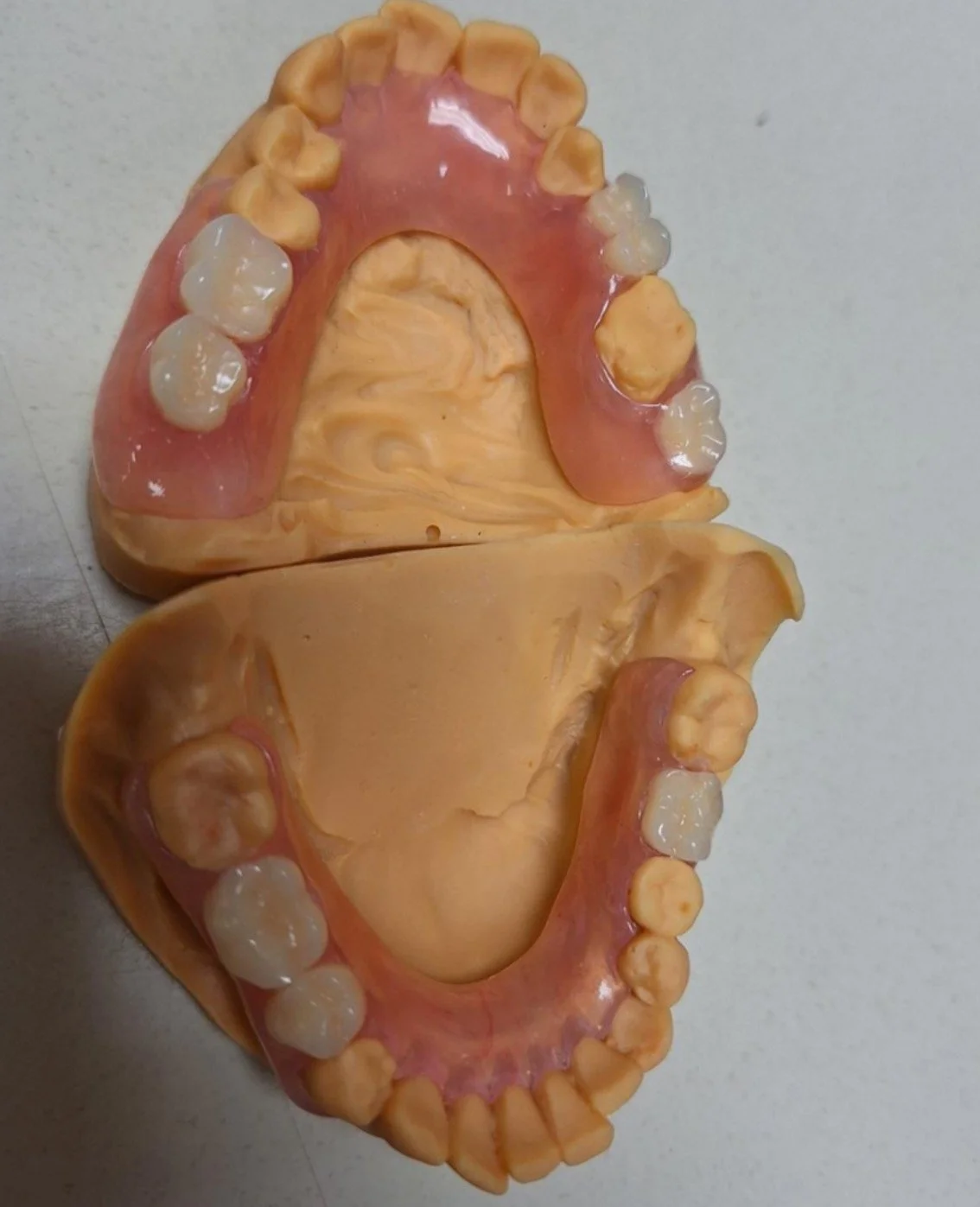 A dental model of the upper and lower jaws showing teeth, gums, and palate.