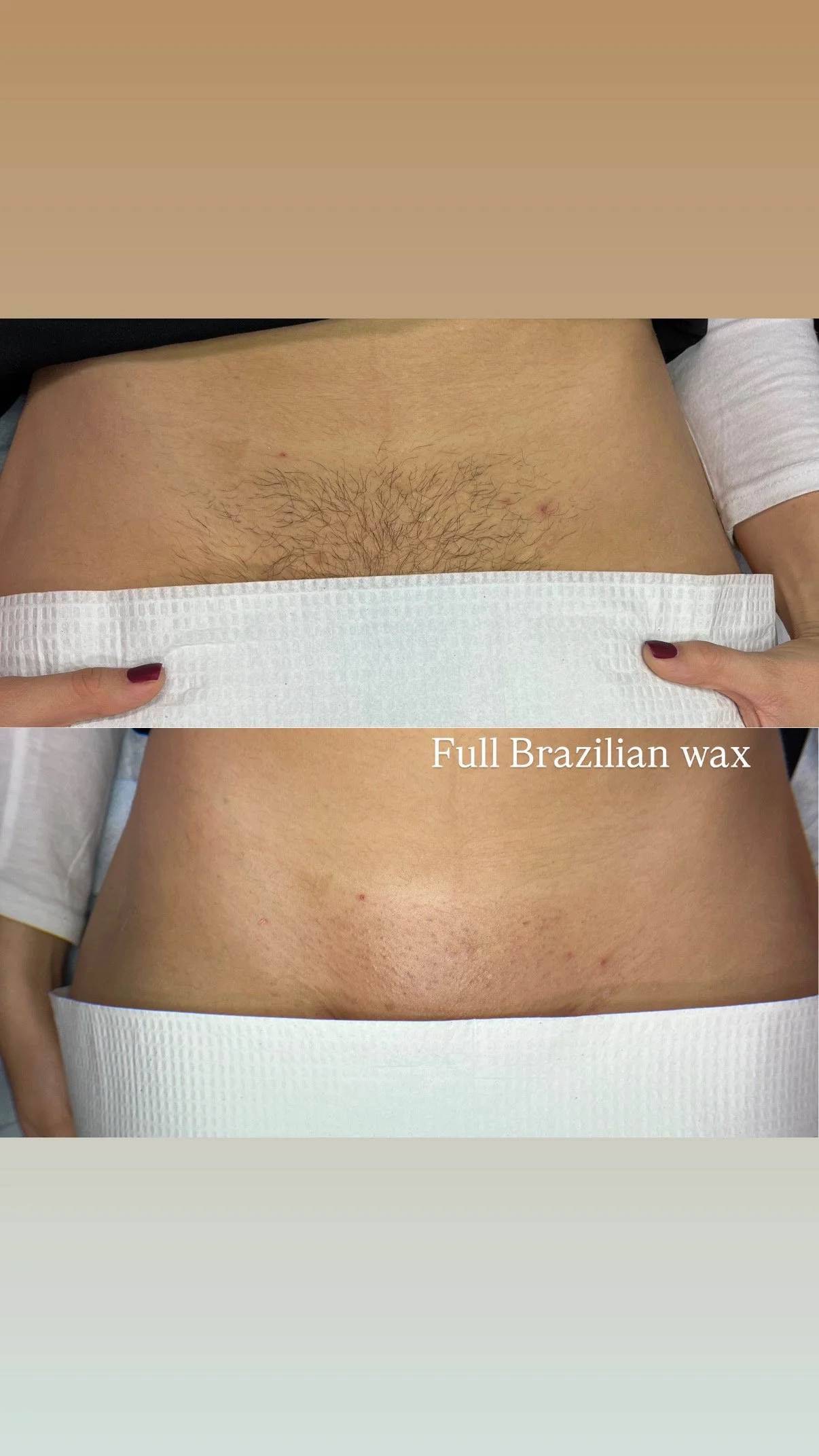 Brazilian wax 2.JPG