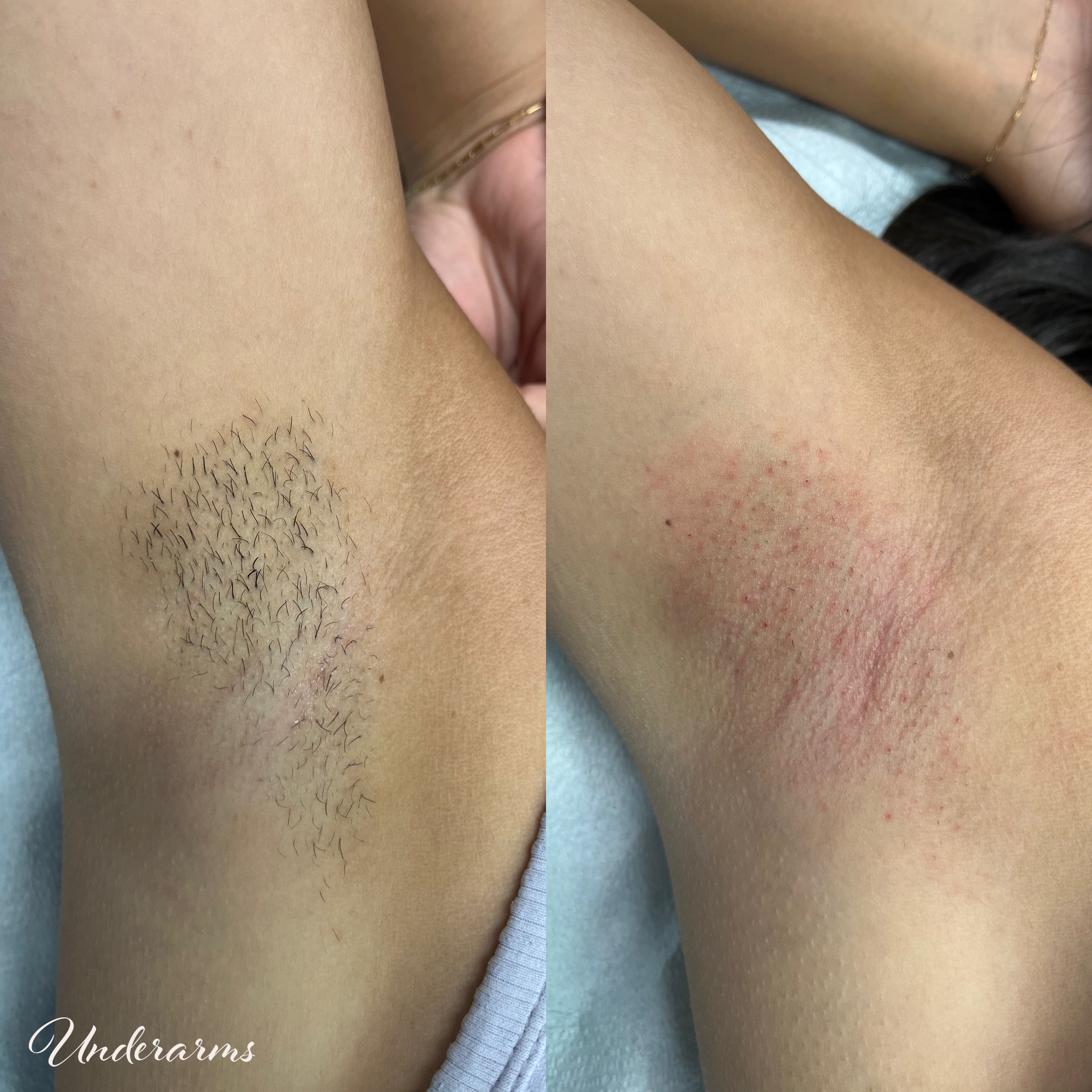 Underarms2.png