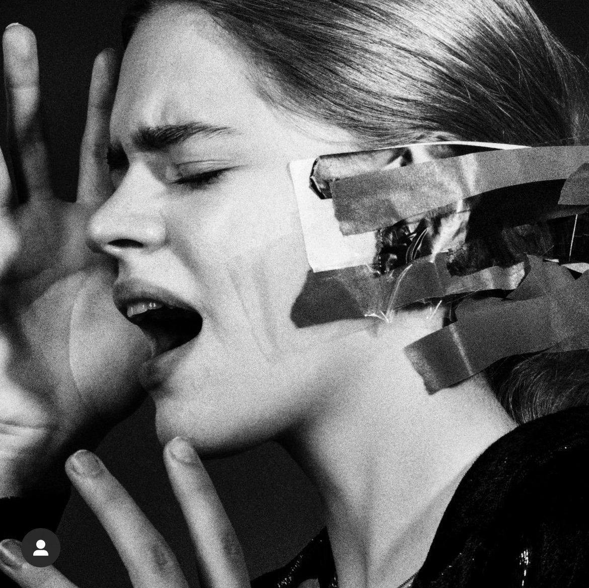 Black and white photo of a woman with her face in profile, eyes closed, mouth open, holding her hand near her face, with tape and paper on her cheek and neck.