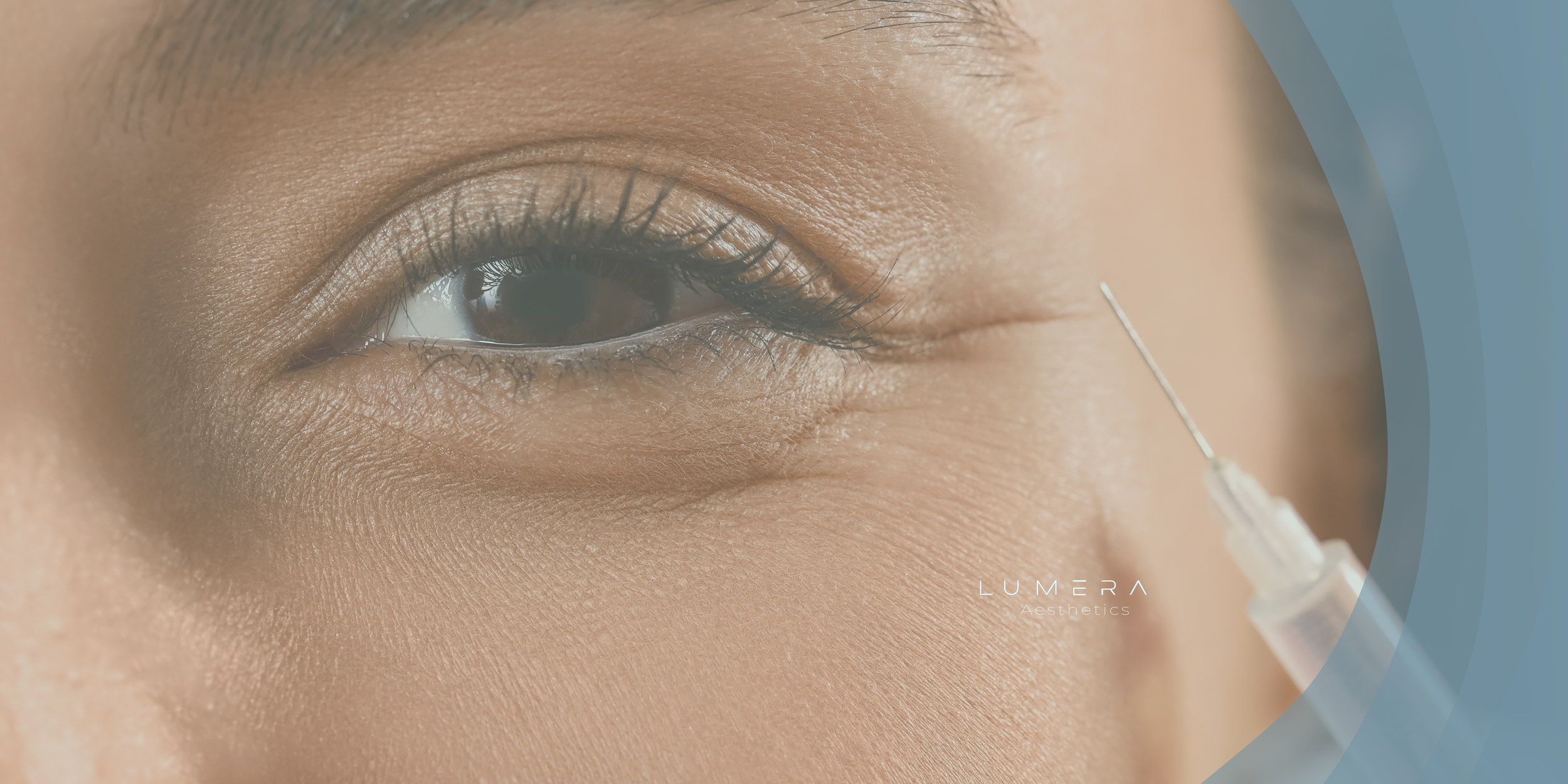 Close-up of a person receiving a cosmetic injection near the eye, with a focus on their eye and surrounding skin.