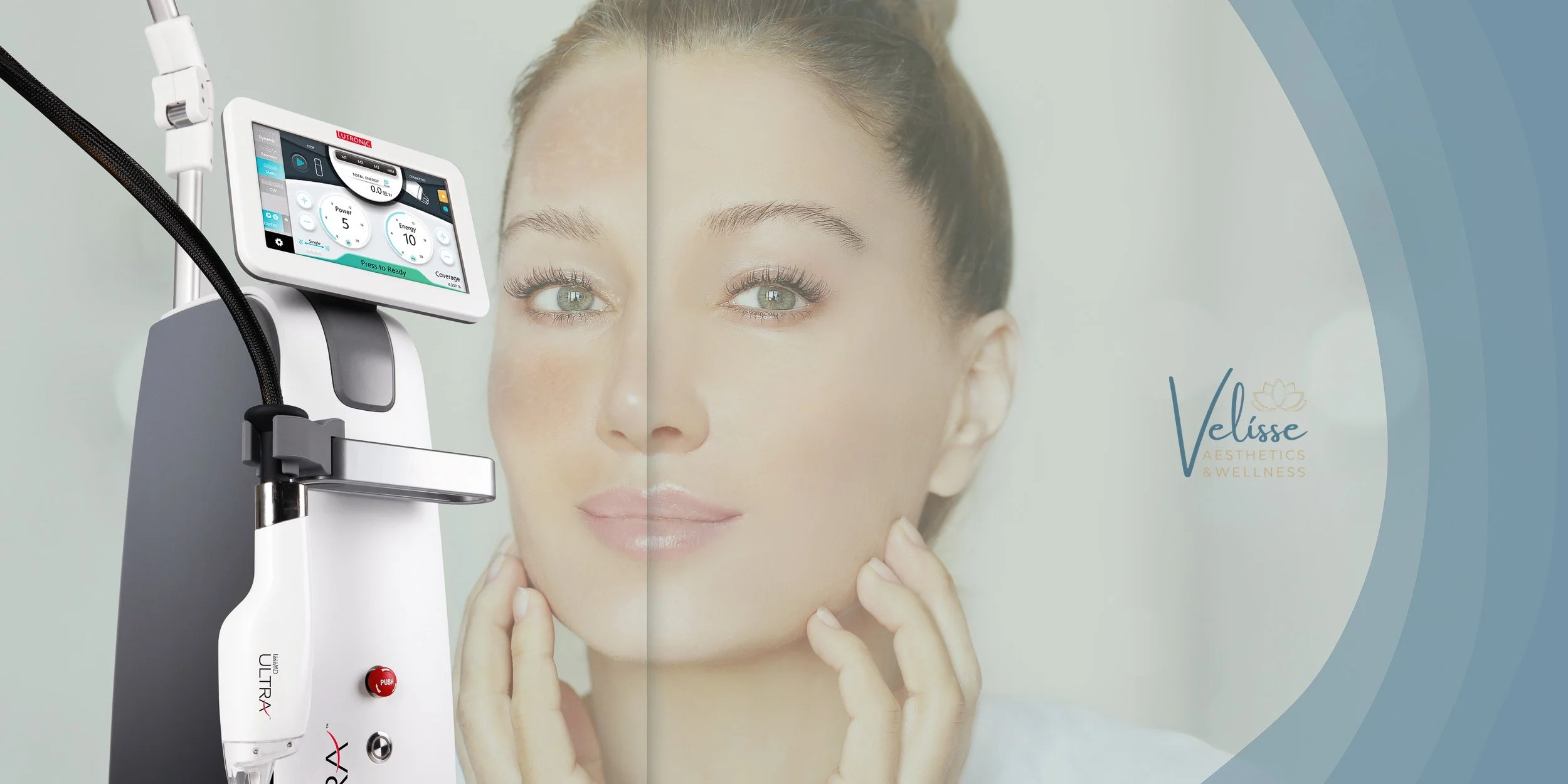 A woman receiving skin treatment with advanced aesthetic equipment during a facial procedure at Lumera Aesthetics clinic.