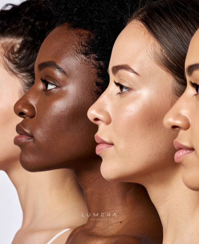 Profile views of four diverse women with different skin tones facing to the right, promoting natural beauty and skin diversity.