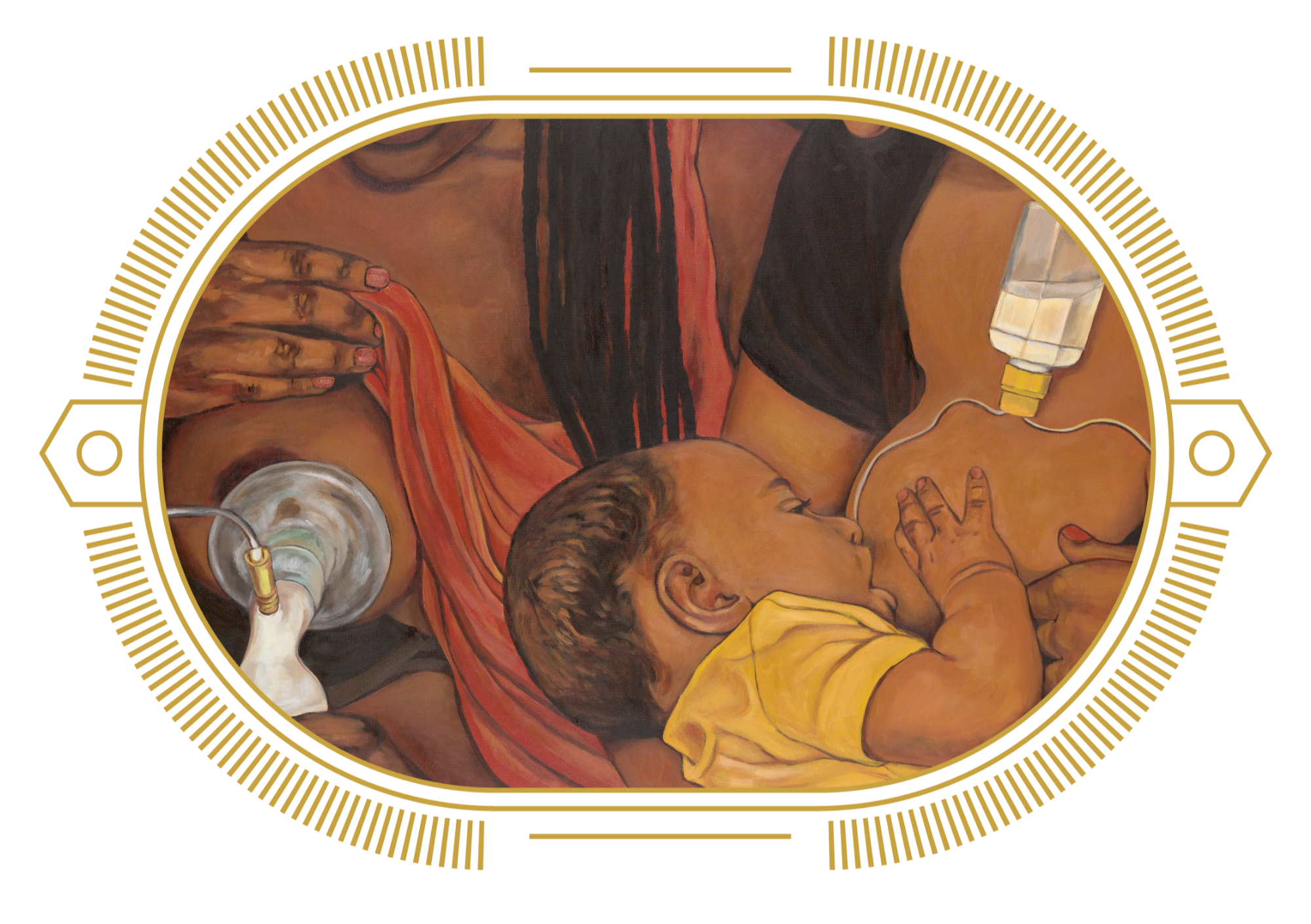 Painting of a mother breastfeeding her infant, with a medical IV catheter attached to her arm.