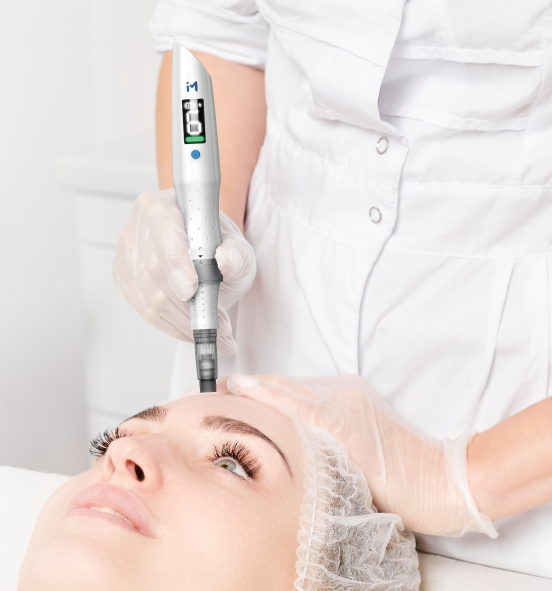 A client receiving Imedpen microneedlingsing a handheld laser device on a woman's forehead during a cosmetic procedure.