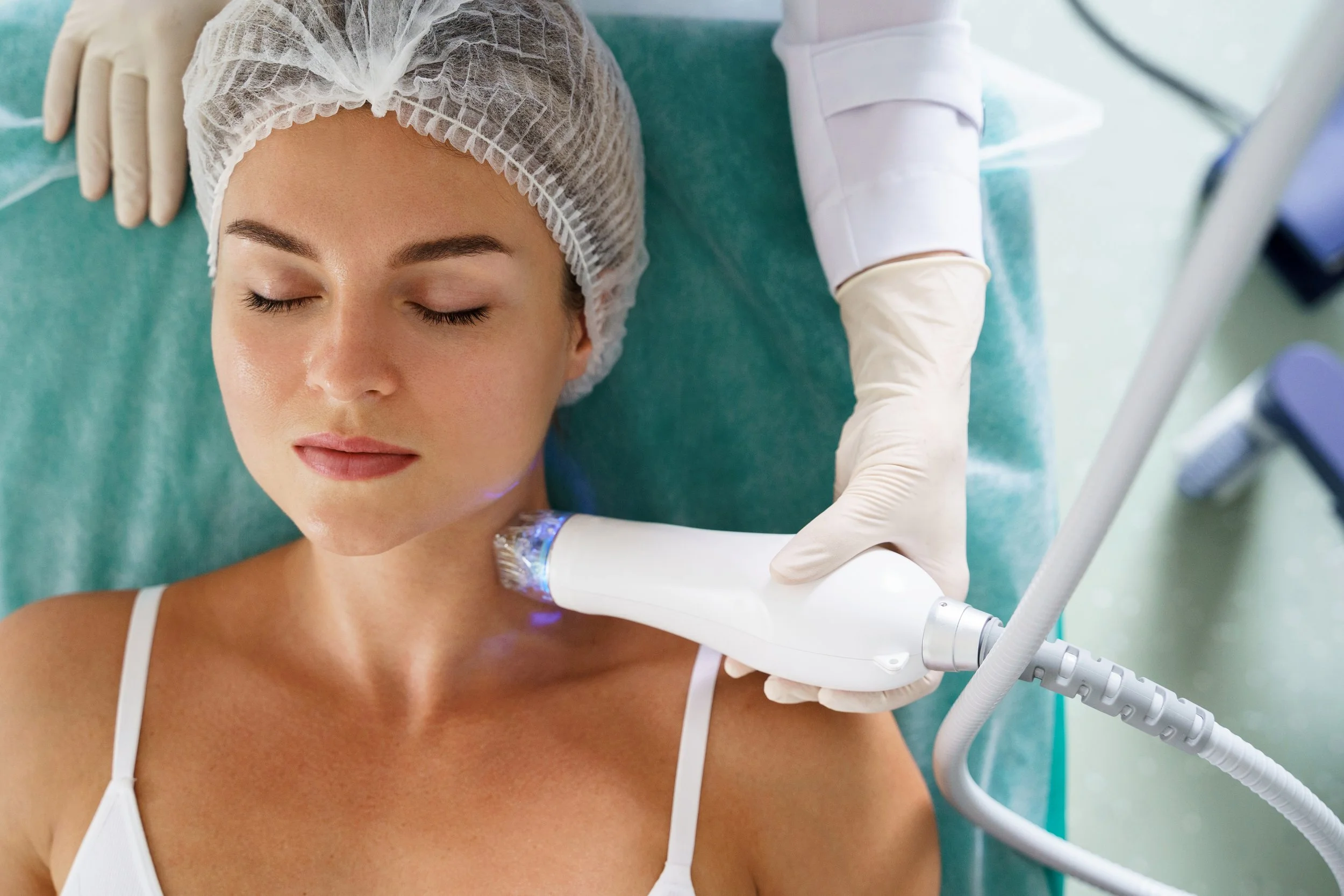 Radiofrequency microneedling