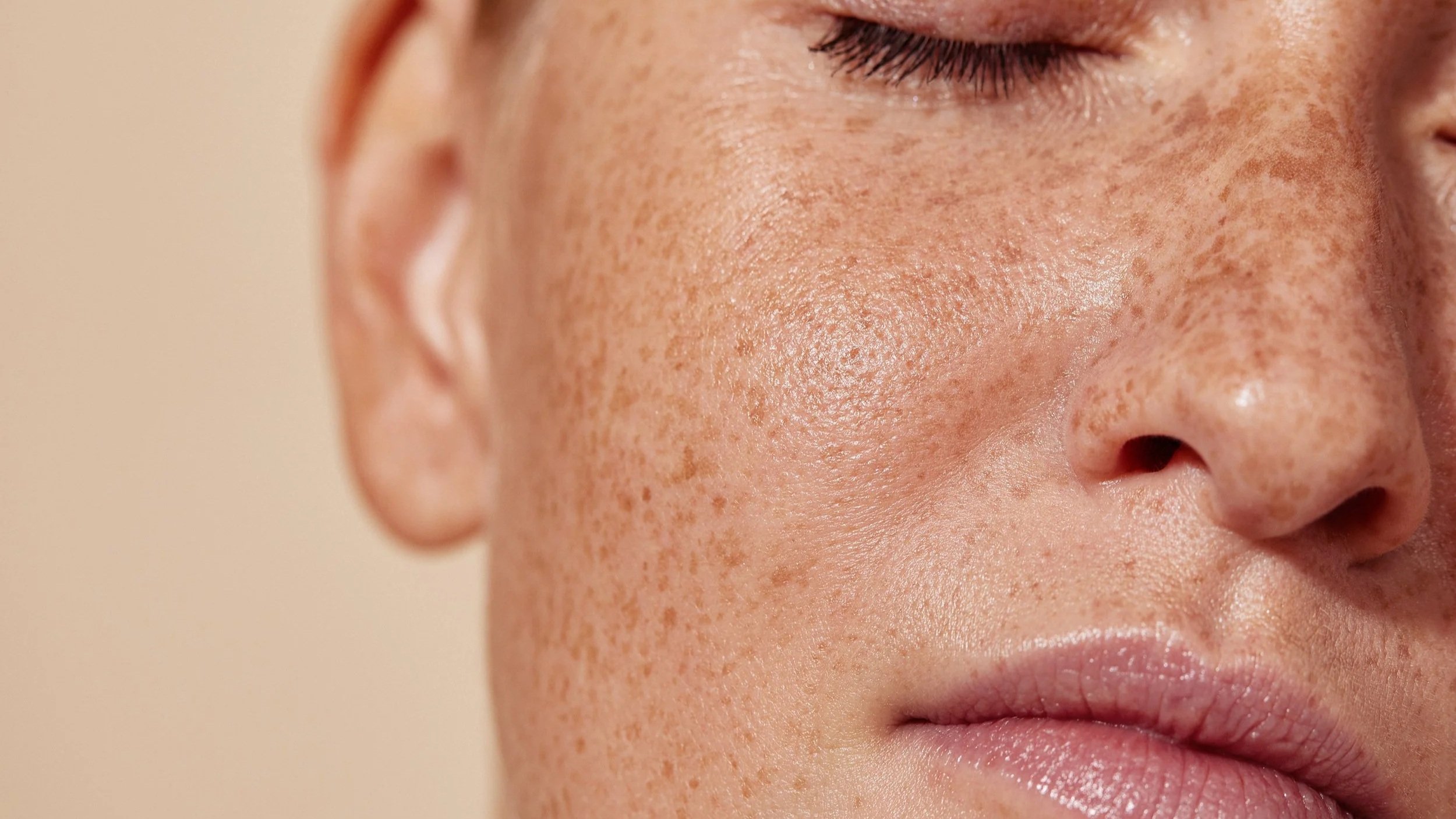 Primer plano de rostro con piel con muchas pecas