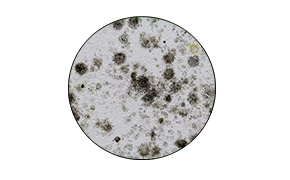 Microscopic view of mold spores on a surface.