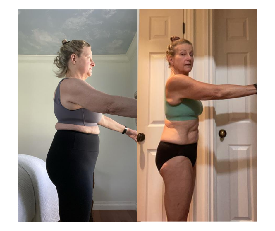 Side-by-side comparison of a woman before and after weight loss, standing with arms extended forward in both images.