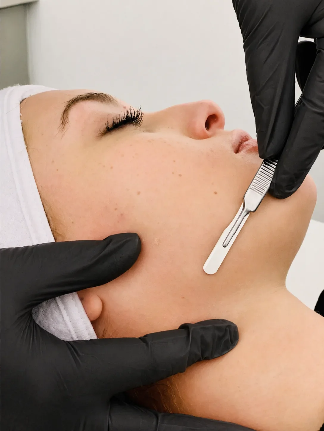 Dermaplane