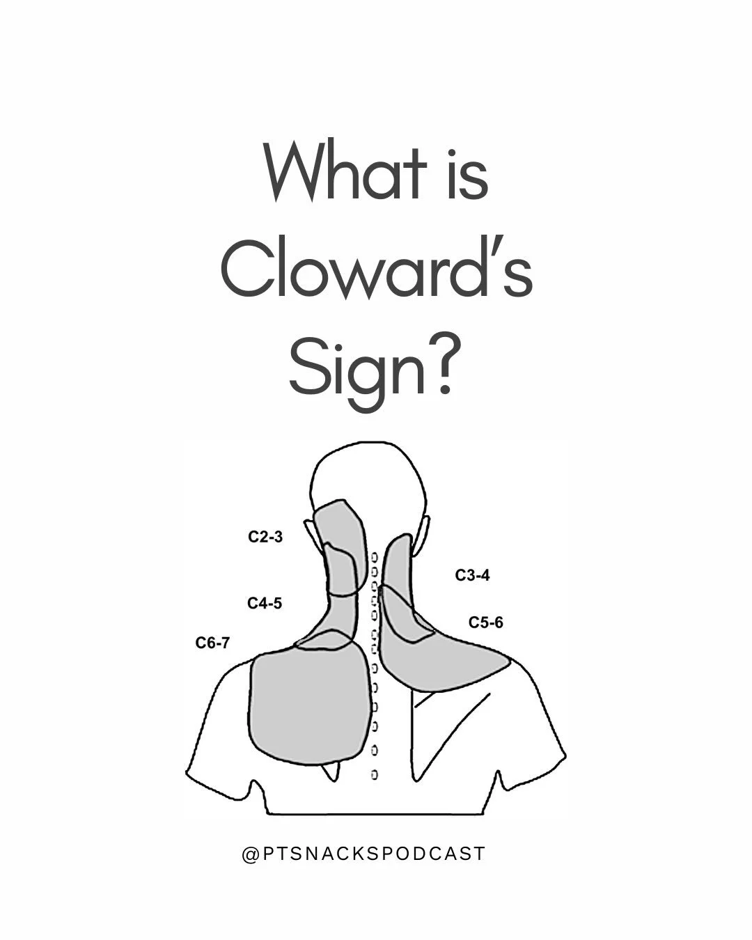 Cloward&rsquo;s sign is a good reminder that screening the surrounding joints isn&rsquo;t &ldquo;extra&rdquo;&mdash;it&rsquo;s how we avoid missing the real source.

🧐Your exam should help you sort out which tissues are actually driving the symptoms