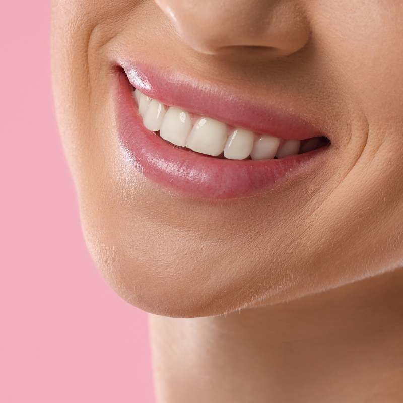 Professional Teeth Whitening - Coming Soon