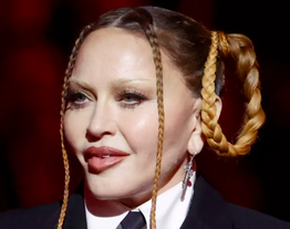 Madonna's Current Face &amp; Marge Simpson Lips
