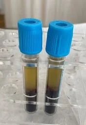 Stop Peeing When You Sneeze