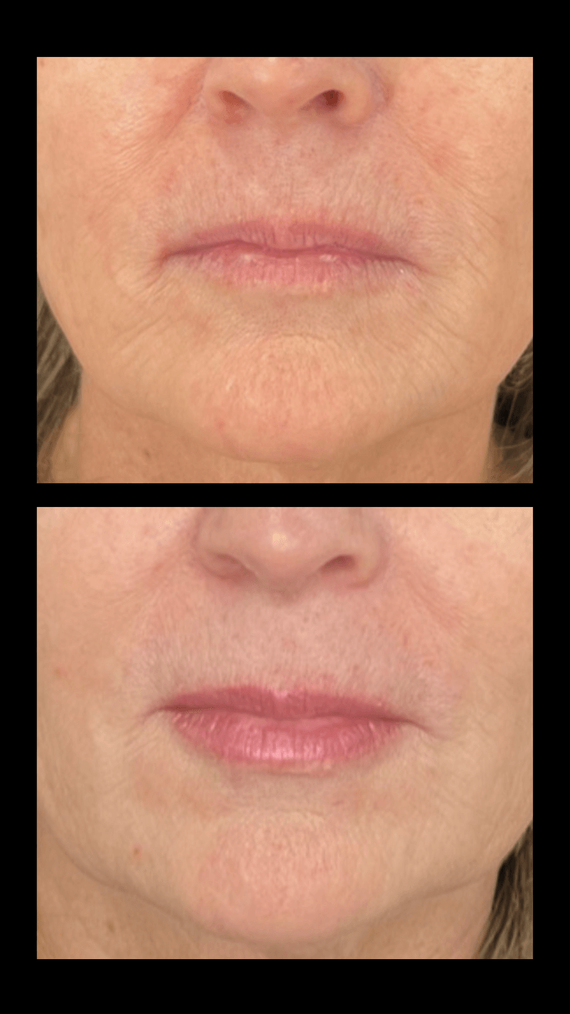 Lips That Enter the Room First