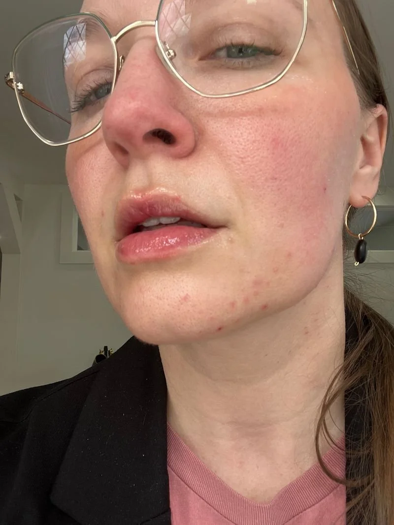 From Teens to Moms: Clear Skin Solutions for New Hampshire Families