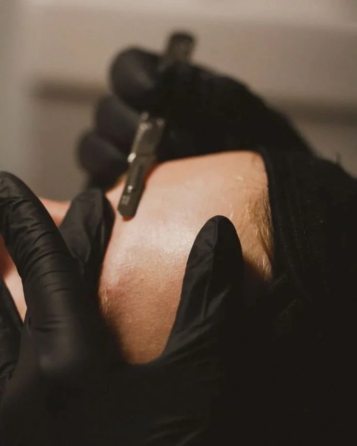 Close-up of a person receiving a microdermabrasion facial treatment with a handheld device, wearing black gloves.