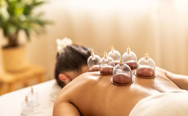 A person receiving a cupping therapy treatment on their back with multiple glass cups placed on skin, in a calming setting.